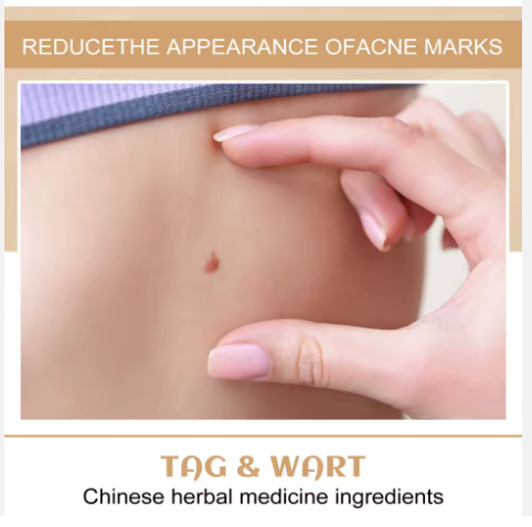 LAPIZ REMOVEDOR DE LUNARES Y VERRUGA