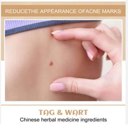 LAPIZ REMOVEDOR DE LUNARES Y VERRUGA