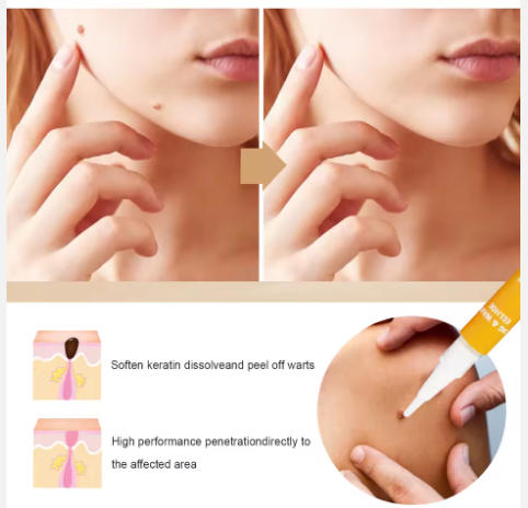 LAPIZ REMOVEDOR DE LUNARES Y VERRUGA